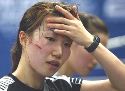 South Korea’s Kim Min-jung accidentally hit in the face by her partner during a training session.